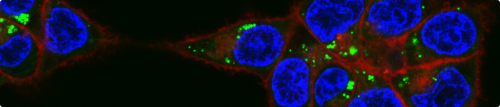 Confocal microscopy image of HCT 116 cells treated with fluorescently labelled poly[N-hydroxyethyl methacrylamide]. Copyright: Dr Laura Purdie.